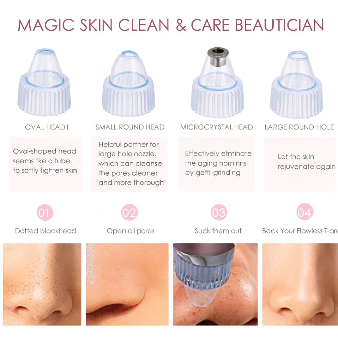 Multi-Functional Blackhead Whitehead Remover
