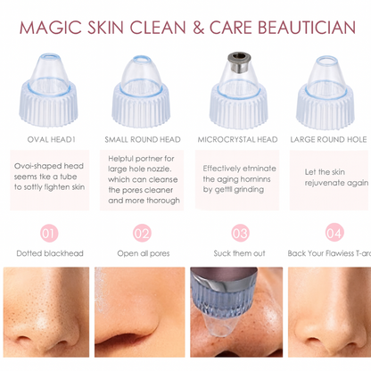 Multi-Functional Blackhead Whitehead Remover